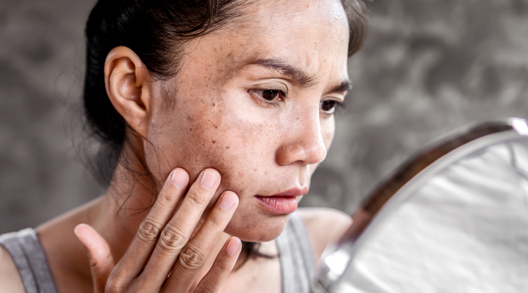 Woman checking skin in mirror