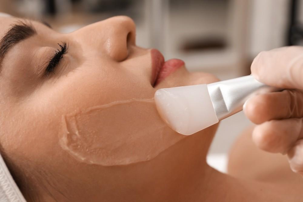 Will I Need Time Off Work? What to Expect After a Chemical Peel