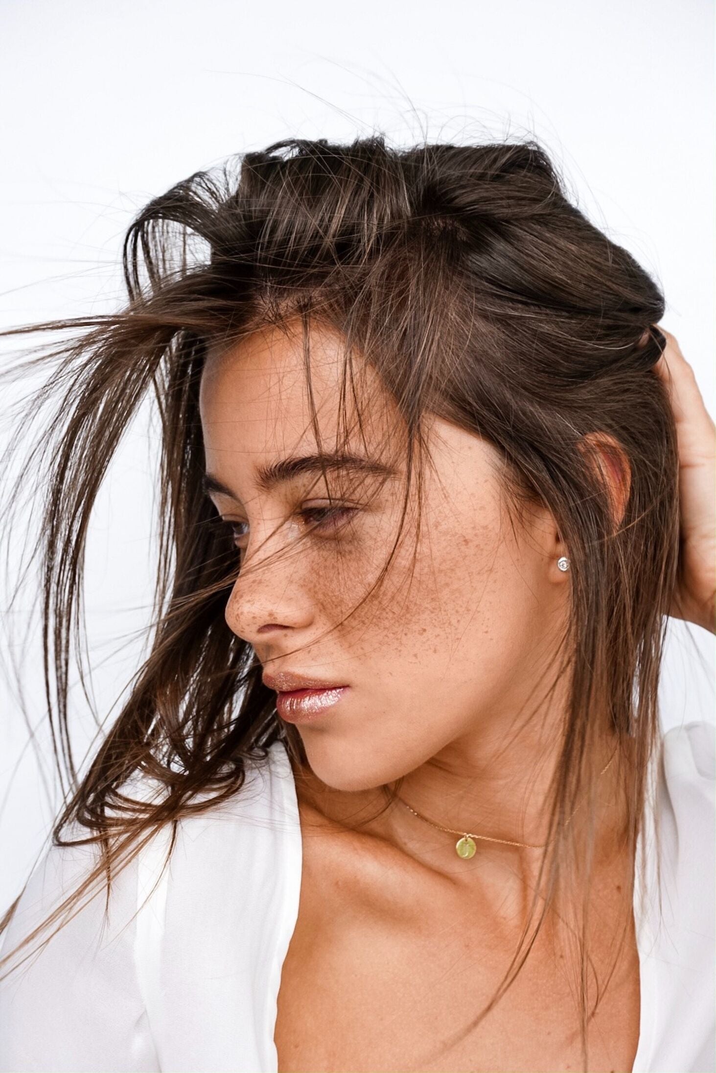 Hyperpigmentation