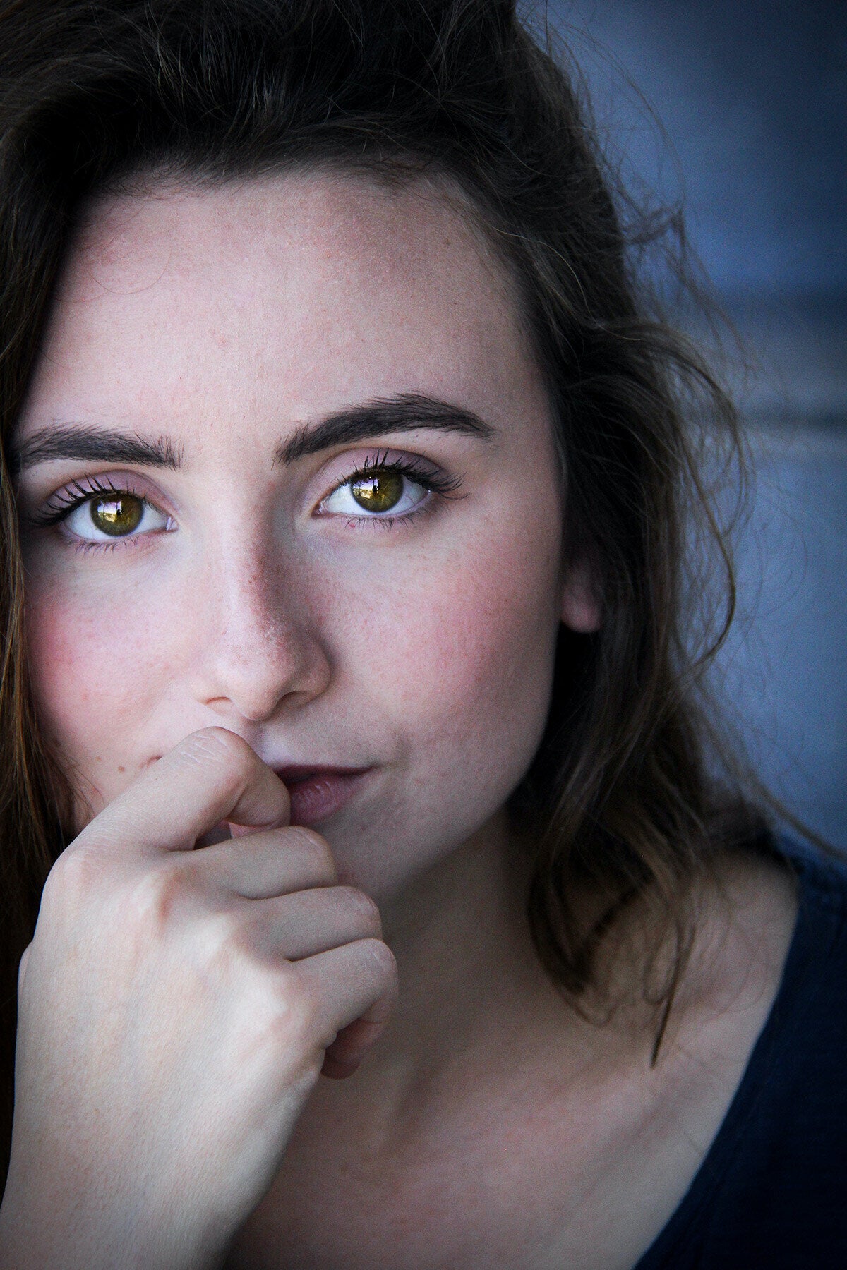 Rosacea
