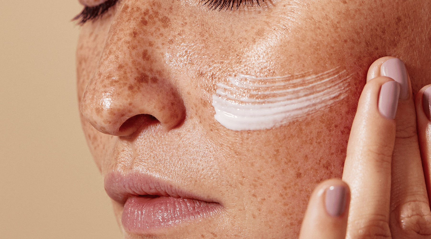 My Pigmentation Journey: What I Tried, What Went Wrong, and What Finally Worked