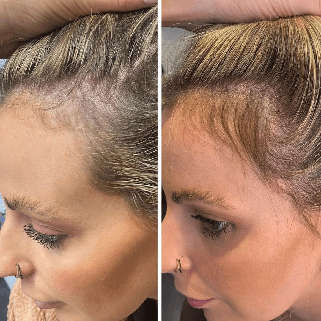 Regen Hair Serum 50mL